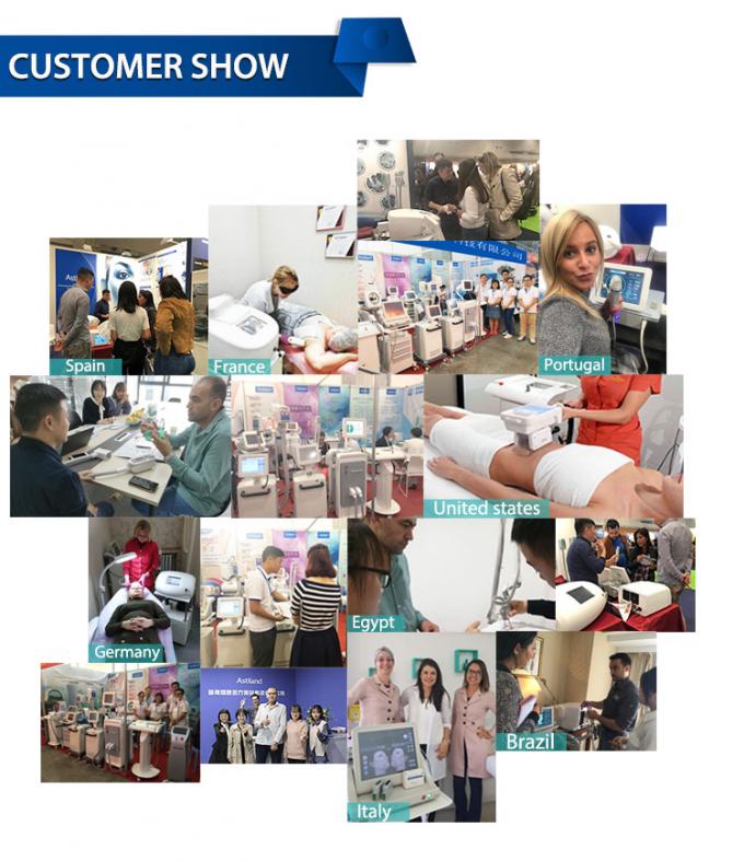 δροσίζοντας μηχανή δερμάτων μηχανών -20c Cryotherapy Zimmer 800w Cryotherapy του προσώπου 15