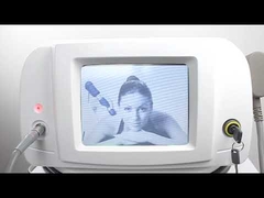 AS-ESWT Φυσικοθεραπεία Μηχανή θεραπείας με σοκ κύματα για πόνο στην πλάτη Πόνος στην οπίσθια