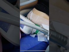 Δοκίμασες να παγώσεις λίπος για απώλεια βάρους;