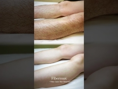 Παρουσιάζουμε την πιο πρόσφατη μηχανή αποτρίχωσης με λέιζερ, την Astiland Fibermax!