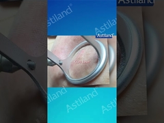 HIFU vs CO2 Laser, ποια αντιγηραντική θεραπεία προτιμάτε;
