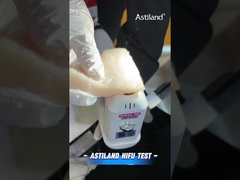 Δοκιμή ενέργειας HIFU