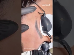 Nd Yag Laser για την αφαίρεση τατουάζ φρυδιών #ndyaglaser #tattooremovallaser #beautymachine #laserclinic