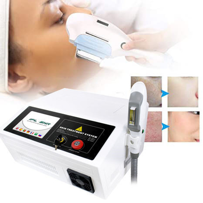 Hair Removal IPL Skin Laser Machine For Skin Rejuvenation Θεραπεία μελάγχρωσης ακμής